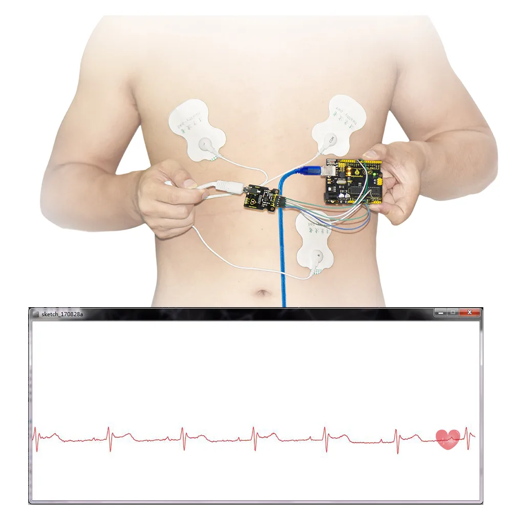 Cardiac bioelectrical signal conditioning