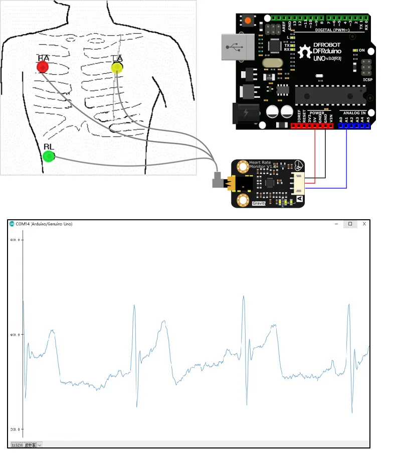 Integrated AD8232 signal conditioning